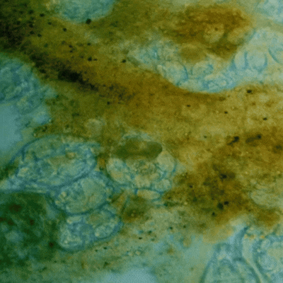 Biofilm protecting the parasites