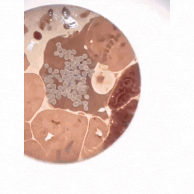 Parasites in the body